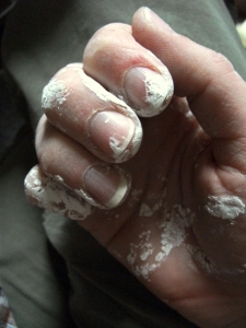 plaster hand